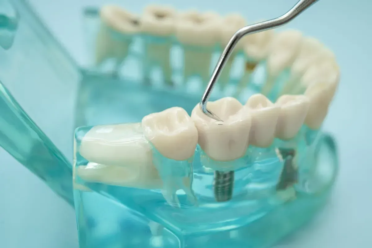 restorative dentistry Newark | Newark Smiles Dental